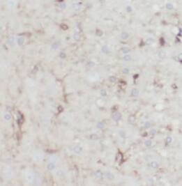 TMEM106B Antibody (6H1)