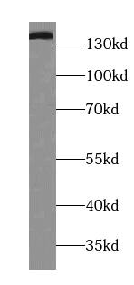 Tripeptidyl peptidase II Antibody (4A3)
