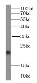 transgelin 2 Antibody (7D0)