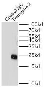 transgelin 2 Antibody (7D0)