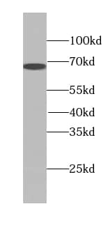 Transketolase Antibody (4E2)