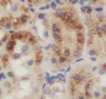 TRAPPC9 Antibody (8A2)