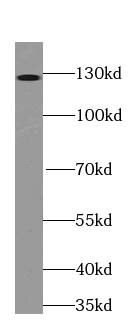 TRAPPC9 Antibody (8A2)
