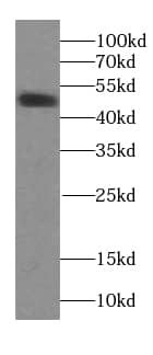 TRIM44 Antibody (9A2)