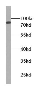 TRUSS Antibody (1C0)