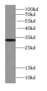 TST Antibody (5E11)