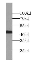 RNA polymerase I termination factor Antibody (4D3)