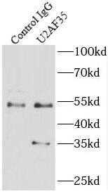 U2AF35 Antibody (1E9)