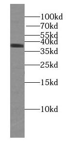 U2AF35 Antibody (1E9)