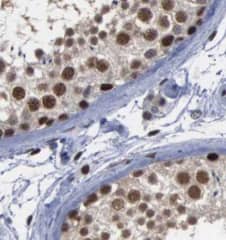 USP13 Antibody (9E6)