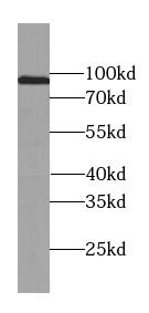 USP13 Antibody (9E6)