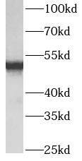 ATPB Antibody (5B3)