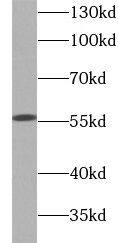 Glucose 6 phosphate isomerase Antibody (4F11)