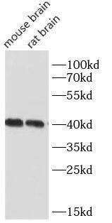 NDRG2 Antibody (4H3)