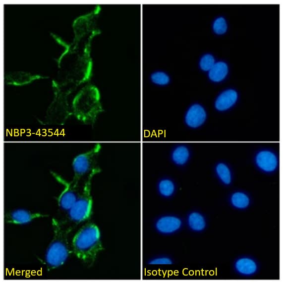 NMDAR2B Antibody (17) - Chimeric - BSA Free