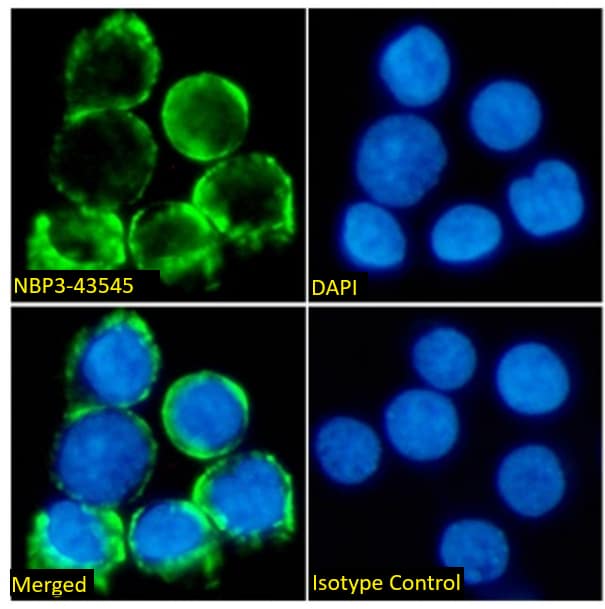 TCR beta Antibody (IARC307) - Chimeric - BSA Free