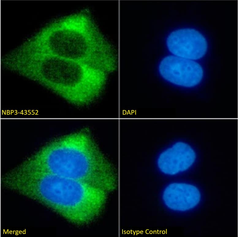 GM2 Ganglioside Antibody (KM966) - Chimeric - BSA Free