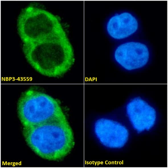 Aquaporin-4 Antibody (C9401) - Chimeric - BSA Free