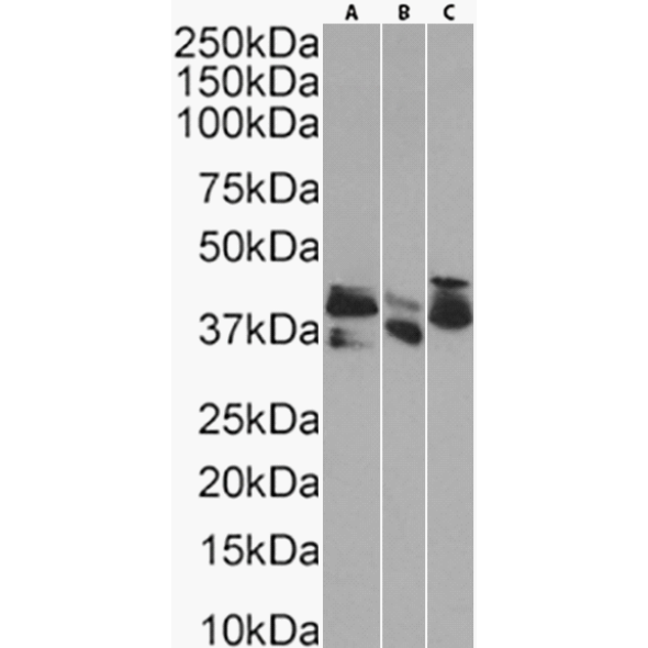 Cytokeratin 20 Antibody (10A2) - Chimeric - BSA Free Cytokeratin 20 Antibody (10A2) - Chimeric - BSA Free