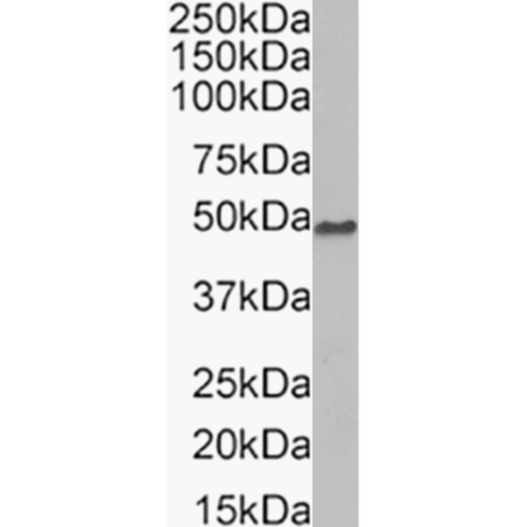 Beta Dystroglycan Antibody (P38G1) - BSA Free Beta Dystroglycan Antibody (P38G1) - BSA Free