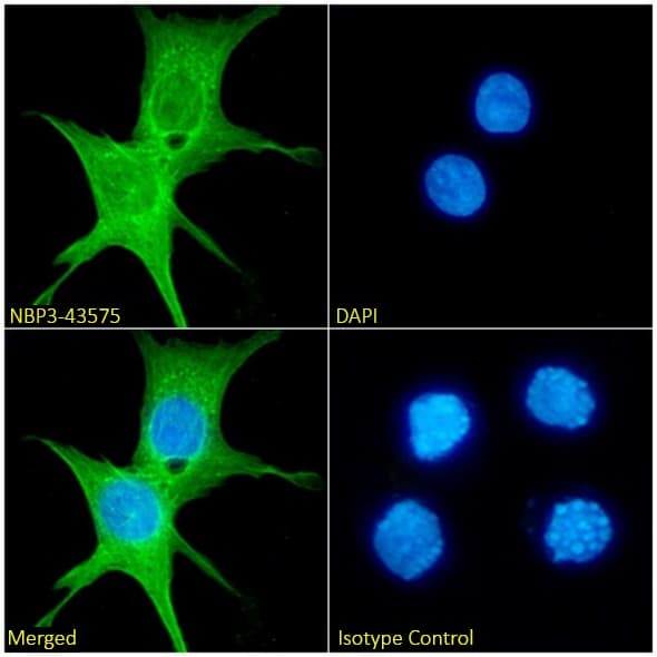 Calponin 2 Antibody (24H5) - Chimeric - BSA Free Calponin 2 Antibody (24H5) - Chimeric - BSA Free