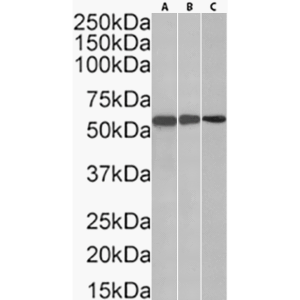 TdT Antibody (32D5) - Chimeric - BSA Free TdT Antibody (32D5) - Chimeric - BSA Free