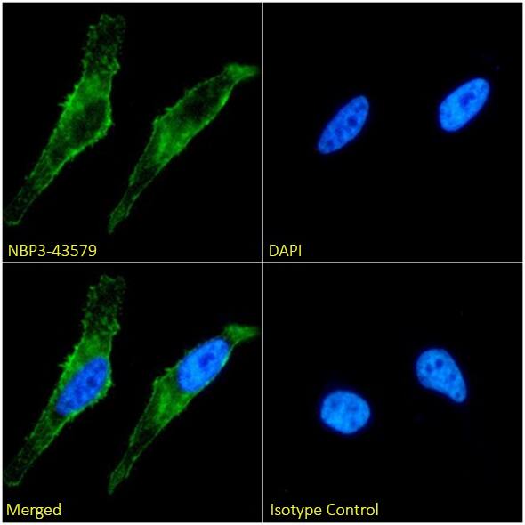 Integrin alpha 5 beta 1 Antibody (SG/19) - Chimeric - BSA Free Integrin alpha 5 beta 1 Antibody (SG/19) - Chimeric - BSA Free