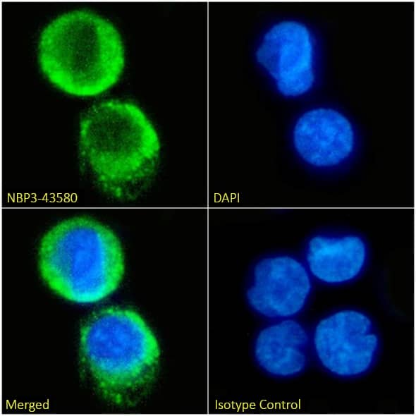 HLA G Antibody (mem-G/9) - BSA Free HLA G Antibody (mem-G/9) - BSA Free