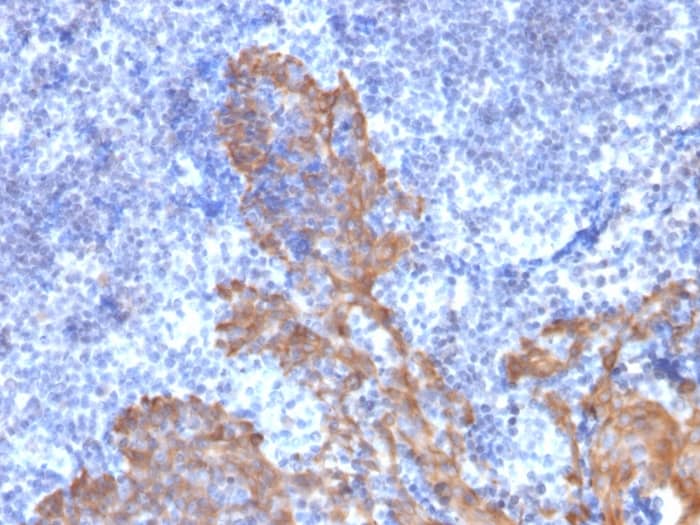 Cytokeratin 5/6 Antibody (KRT5.6/2090) - Azide and BSA Free Immunohistochemistry-Paraffin: Cytokeratin 5/6 Antibody (KRT5.6/2090) - Azide and BSA Free [NBP3-43589] -