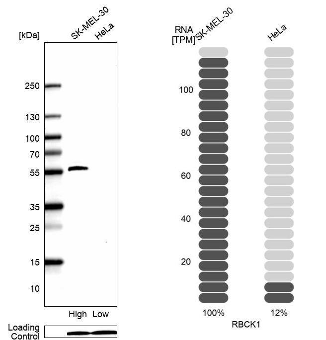 RBCK1 Antibody (CL4290) [Unconjugated] Western blot: RBCK1 Antibody (CL4290) [NBP3-43640]