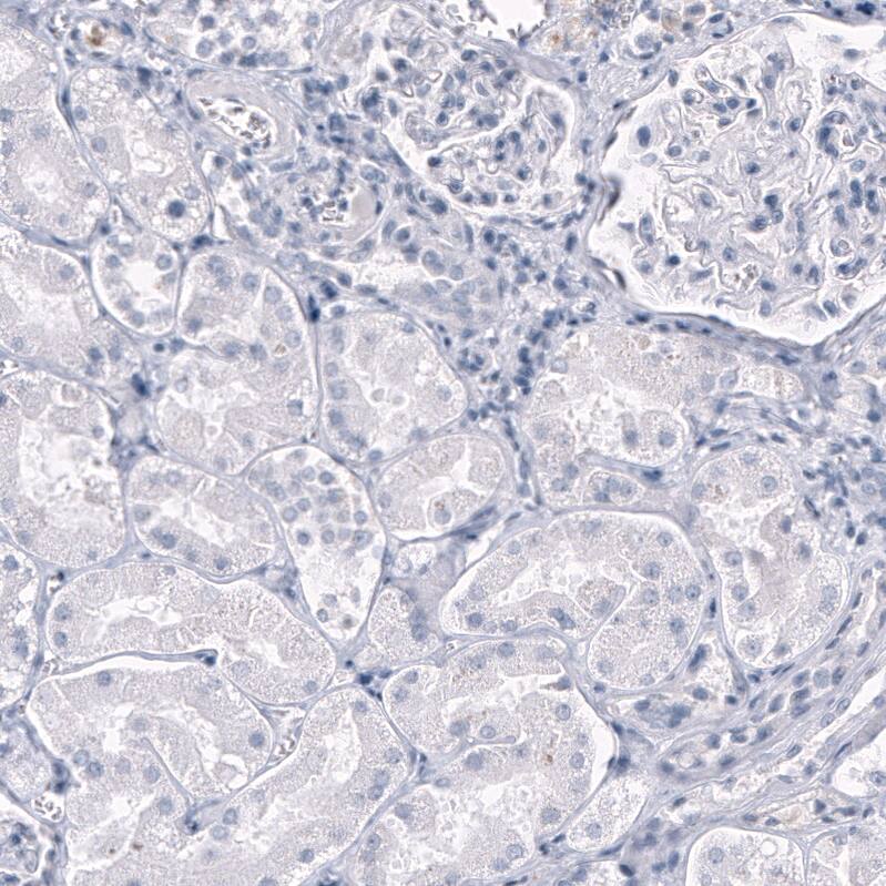OPALIN Antibody (CL11142) [Unconjugated] Immunohistochemistry-Paraffin: OPALIN Antibody (CL11142) [NBP3-43641]
