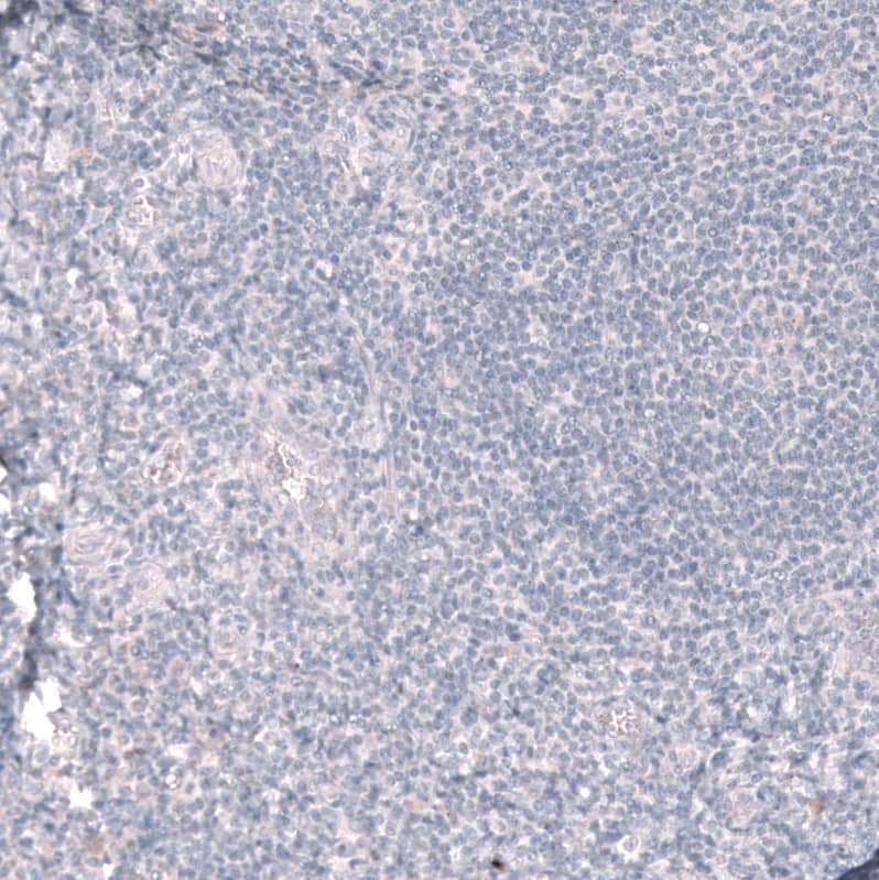 ABCB5 Antibody (CL13618) [Unconjugated] Immunohistochemistry-Paraffin: ABCB5 Antibody (CL13618) [NBP3-43642]