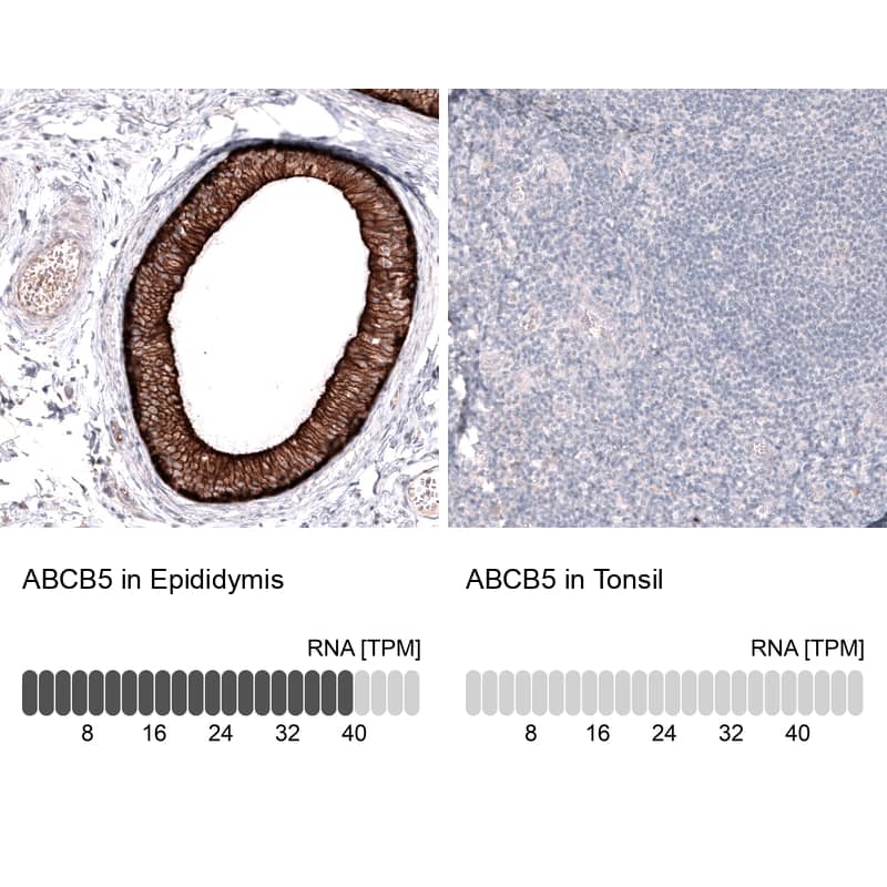 ABCB5 Antibody (CL13618) [Unconjugated] Immunohistochemistry-Paraffin: ABCB5 Antibody (CL13618) [NBP3-43642]