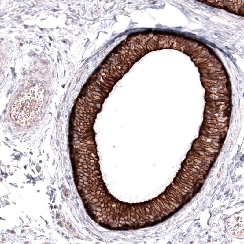 ABCB5 Antibody (CL13618) [Unconjugated] Immunohistochemistry-Paraffin: ABCB5 Antibody (CL13618) [NBP3-43642]