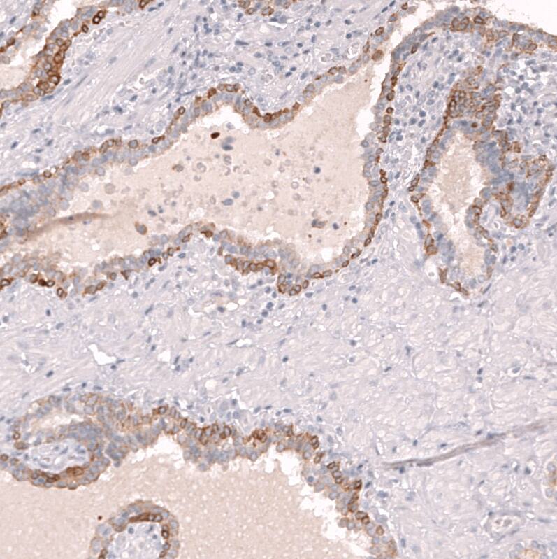 ABCB5 Antibody (CL13618) [Unconjugated] Immunohistochemistry-Paraffin: ABCB5 Antibody (CL13618) [NBP3-43642]