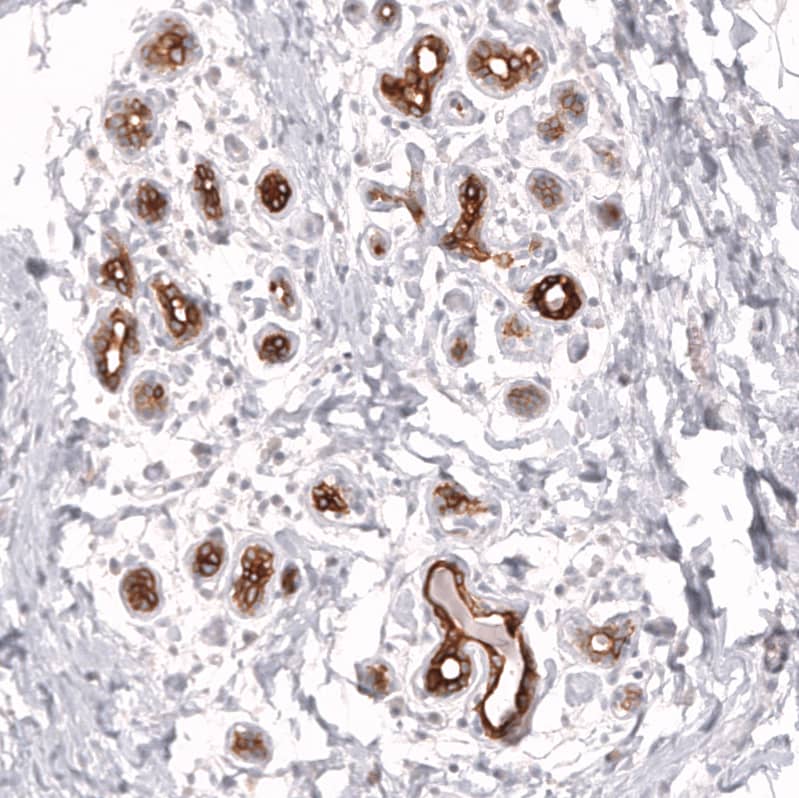 ABCB5 Antibody (CL13618) [Unconjugated] Immunohistochemistry-Paraffin: ABCB5 Antibody (CL13618) [NBP3-43642]