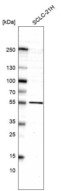 LHX9 Antibody (CL15033) [Unconjugated] Western blot: LHX9 Antibody (CL15033) [NBP3-43644]