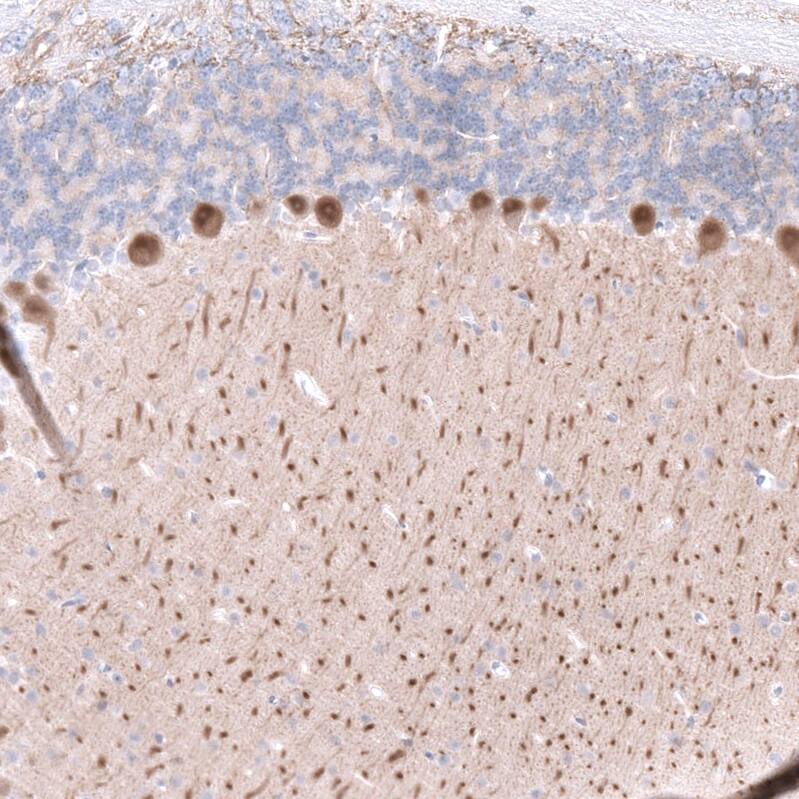 Calbindin D-28K Antibody (CL15060) [Unconjugated] Immunohistochemistry-Paraffin: Calbindin D-28K Antibody (CL15060) [NBP3-43645]