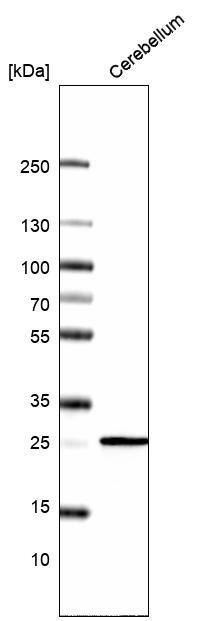 Calbindin D-28K Antibody (CL15060) [Unconjugated] Western blot: Calbindin D-28K Antibody (CL15060) [NBP3-43645]