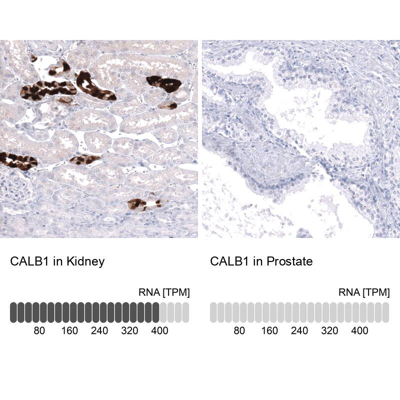 Calbindin D-28K Antibody (CL15060) [Unconjugated] Immunohistochemistry-Paraffin: Calbindin D-28K Antibody (CL15060) [NBP3-43645]