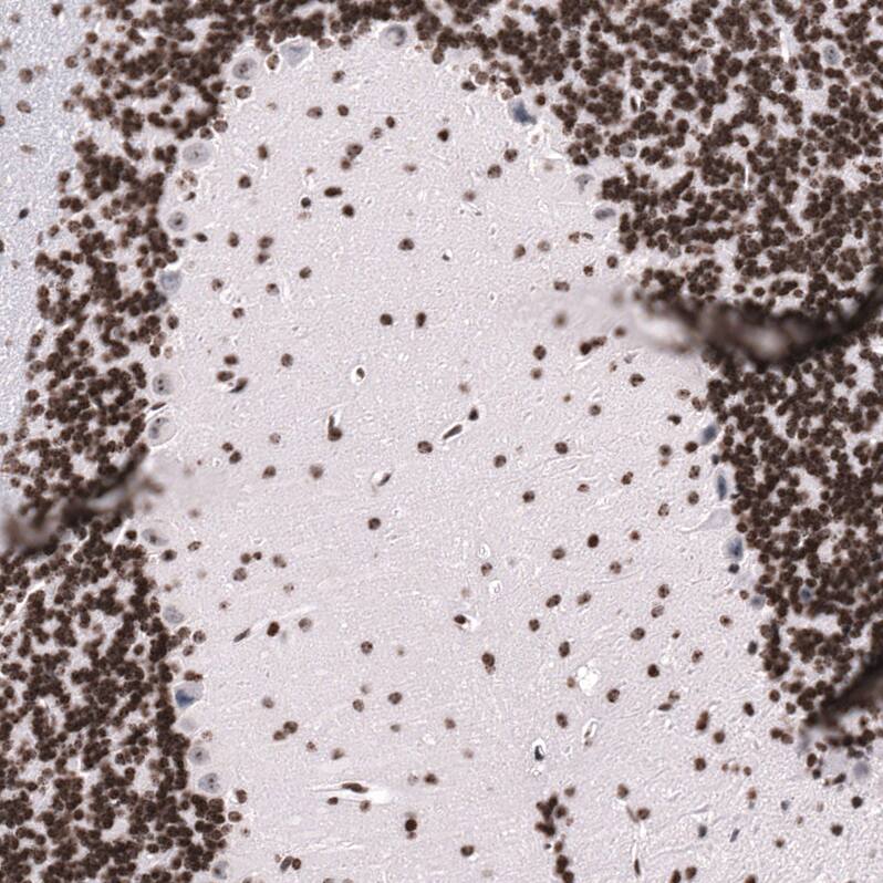 LHX9 Antibody (CL15043) [Unconjugated] Immunohistochemistry-Paraffin: LHX9 Antibody (CL15043) [NBP3-43646]