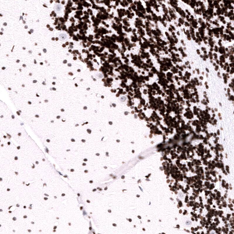 LHX9 Antibody (CL15043) [Unconjugated] Immunohistochemistry-Paraffin: LHX9 Antibody (CL15043) [NBP3-43646]