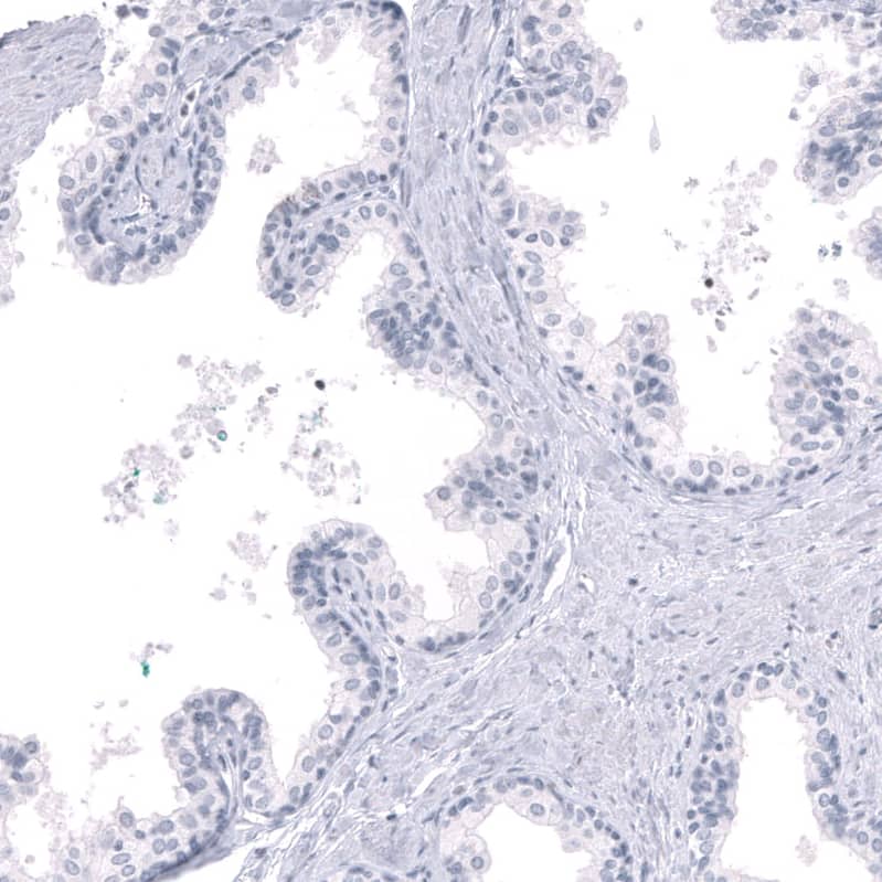 LHX9 Antibody (CL15043) [Unconjugated] Immunohistochemistry-Paraffin: LHX9 Antibody (CL15043) [NBP3-43646]