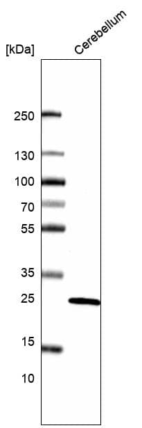 Calbindin D-28K Antibody (CL15059) [Unconjugated] Western blot: Calbindin D-28K Antibody (CL15059) [NBP3-43647]