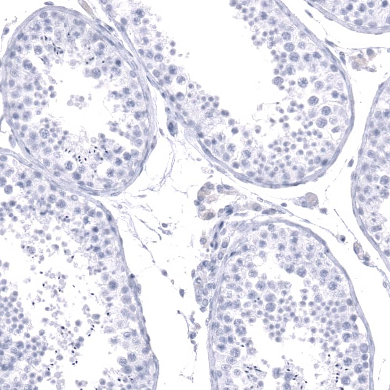 Calbindin D-28K Antibody (CL15059) [Unconjugated] Immunohistochemistry-Paraffin: Calbindin D-28K Antibody (CL15059) [NBP3-43647]