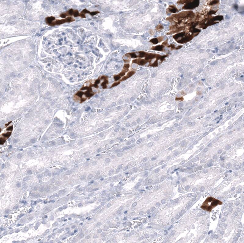 Calbindin D-28K Antibody (CL15059) [Unconjugated] Immunohistochemistry-Paraffin: Calbindin D-28K Antibody (CL15059) [NBP3-43647]