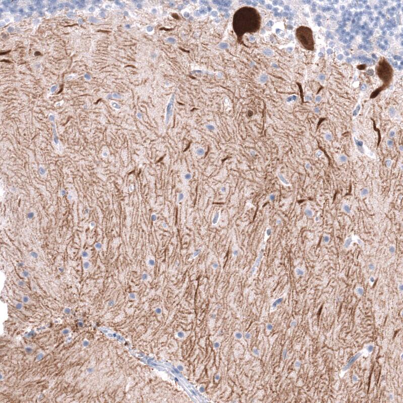 Calbindin D-28K Antibody (CL15059) [Unconjugated] Immunohistochemistry-Paraffin: Calbindin D-28K Antibody (CL15059) [NBP3-43647]
