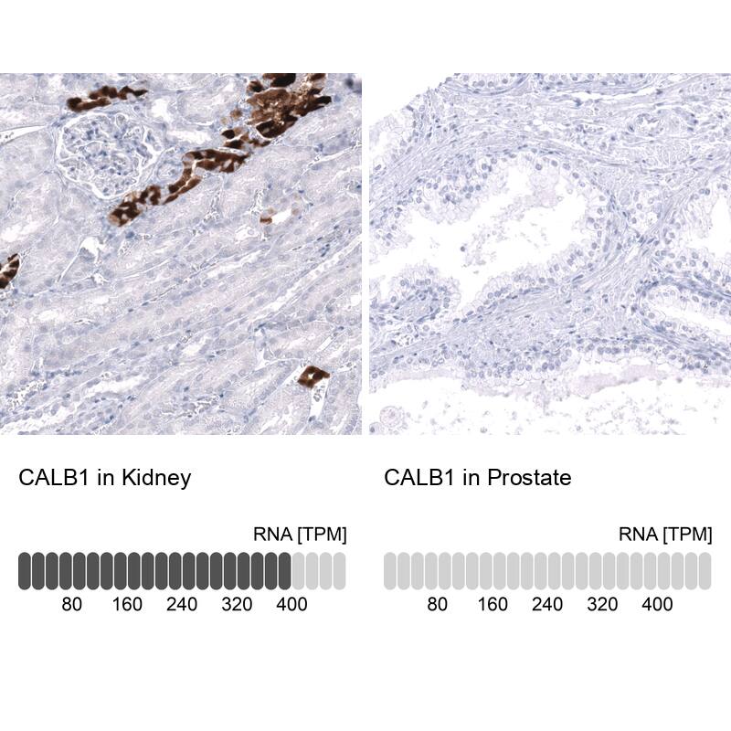 Calbindin D-28K Antibody (CL15059) [Unconjugated] Immunohistochemistry-Paraffin: Calbindin D-28K Antibody (CL15059) [NBP3-43647]