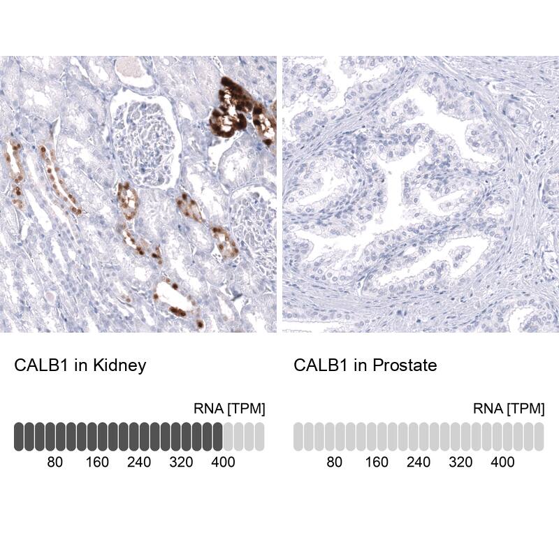 Calbindin D-28K Antibody (CL15065) [Unconjugated] Immunohistochemistry-Paraffin: Calbindin D-28K Antibody (CL15065) [NBP3-43648]