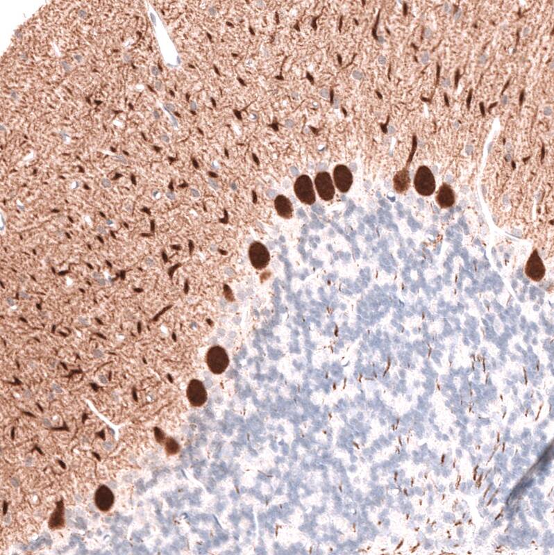 Calbindin D-28K Antibody (CL15065) [Unconjugated] Immunohistochemistry-Paraffin: Calbindin D-28K Antibody (CL15065) [NBP3-43648]